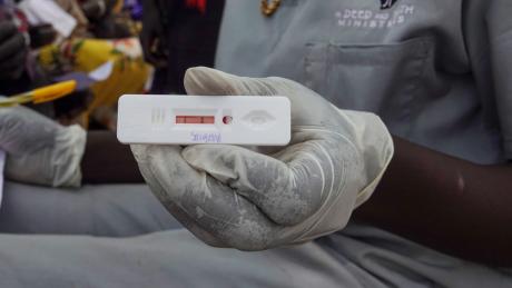 Positive malaria test